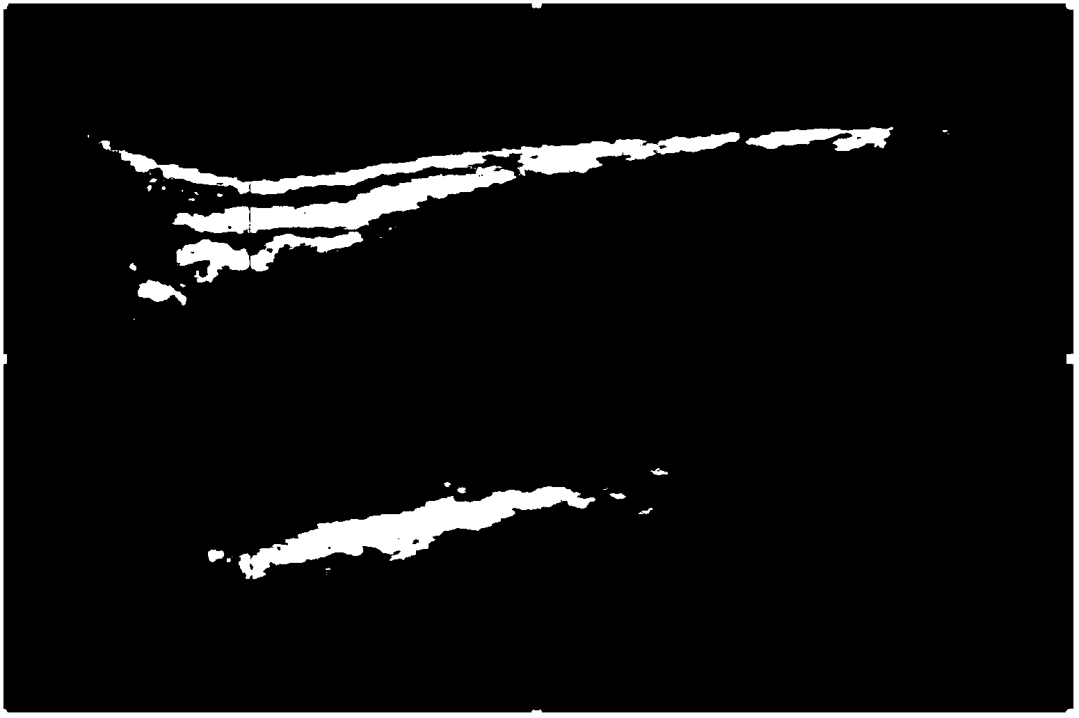 Automatic dividing method of ultrasound carotid artery vascular membrane