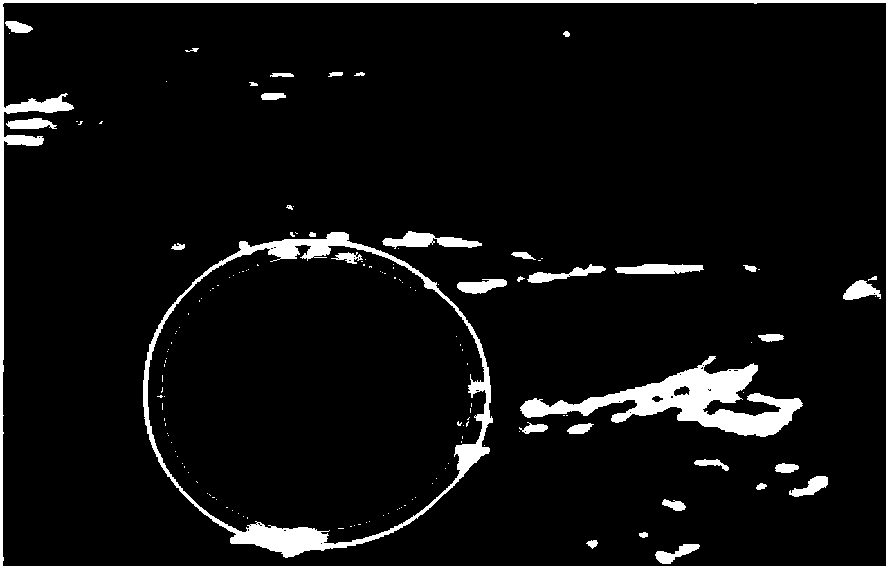 Automatic dividing method of ultrasound carotid artery vascular membrane