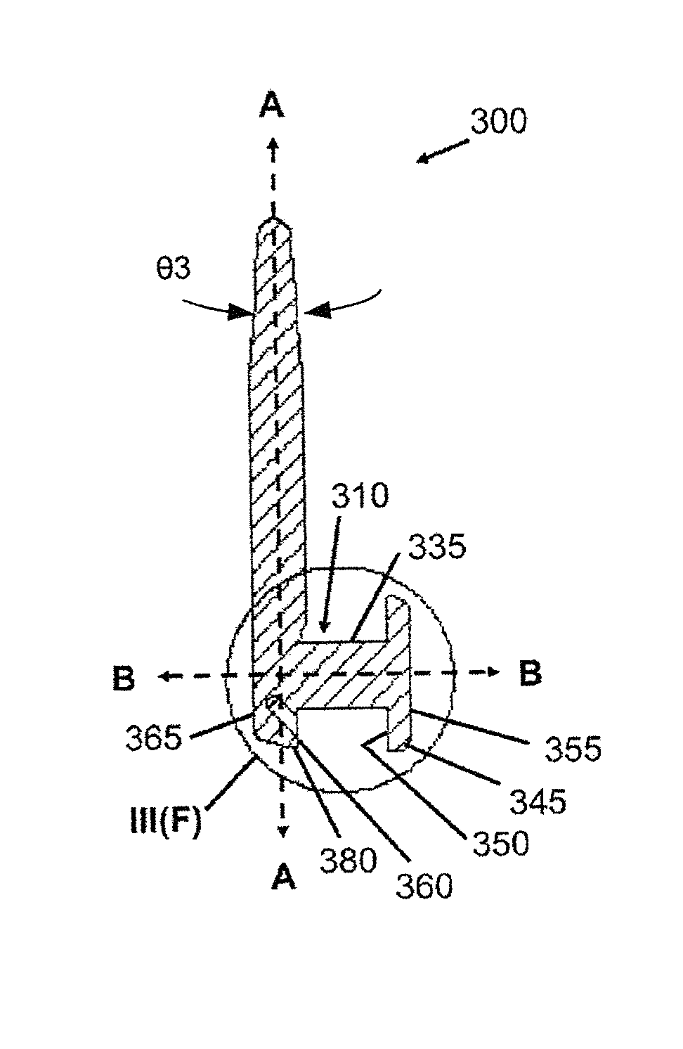 Drug delivery system and methods of treating open angle glaucoma and ocular hypertension