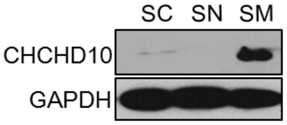 Application of chchd10 in promoting achr subunit gene expression and maintaining nmj stability