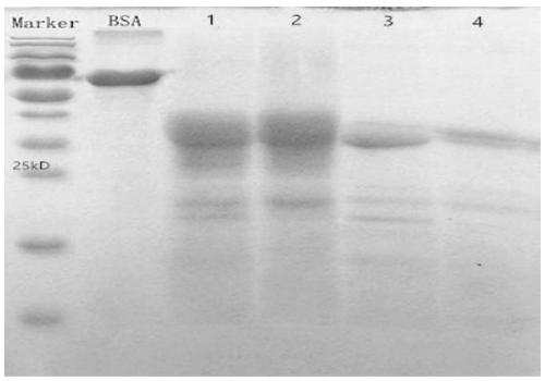 Monoclonal antibody resisting skeletal muscle troponin I and application of monoclonal antibody