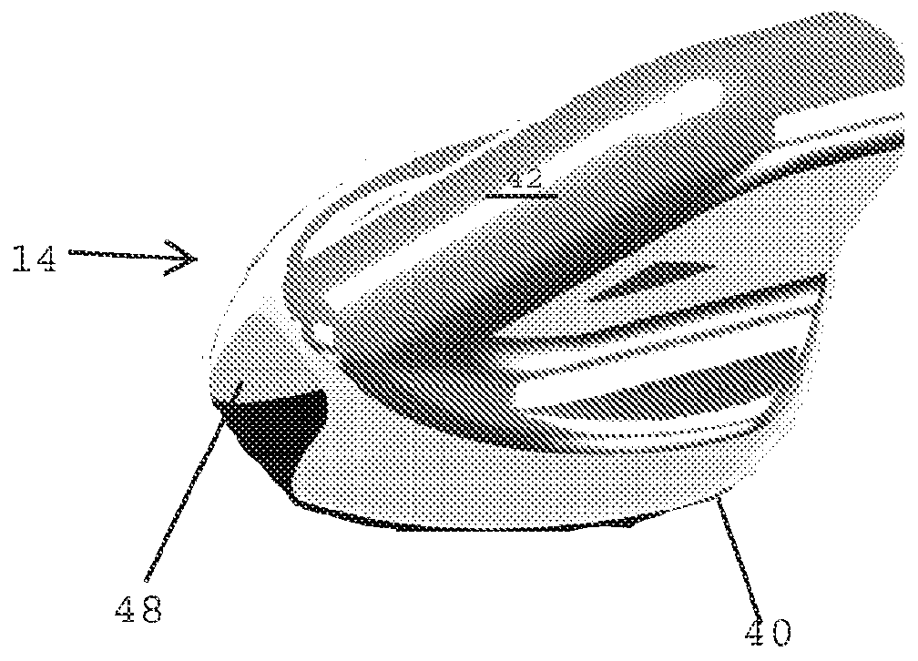 Access Device for Surgery