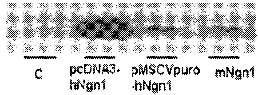 Adult stem cell line introduced with hepatocyte growth factor gene and neurogenic transcription factor gene with basic helix-loop-helix motif and uses thereof