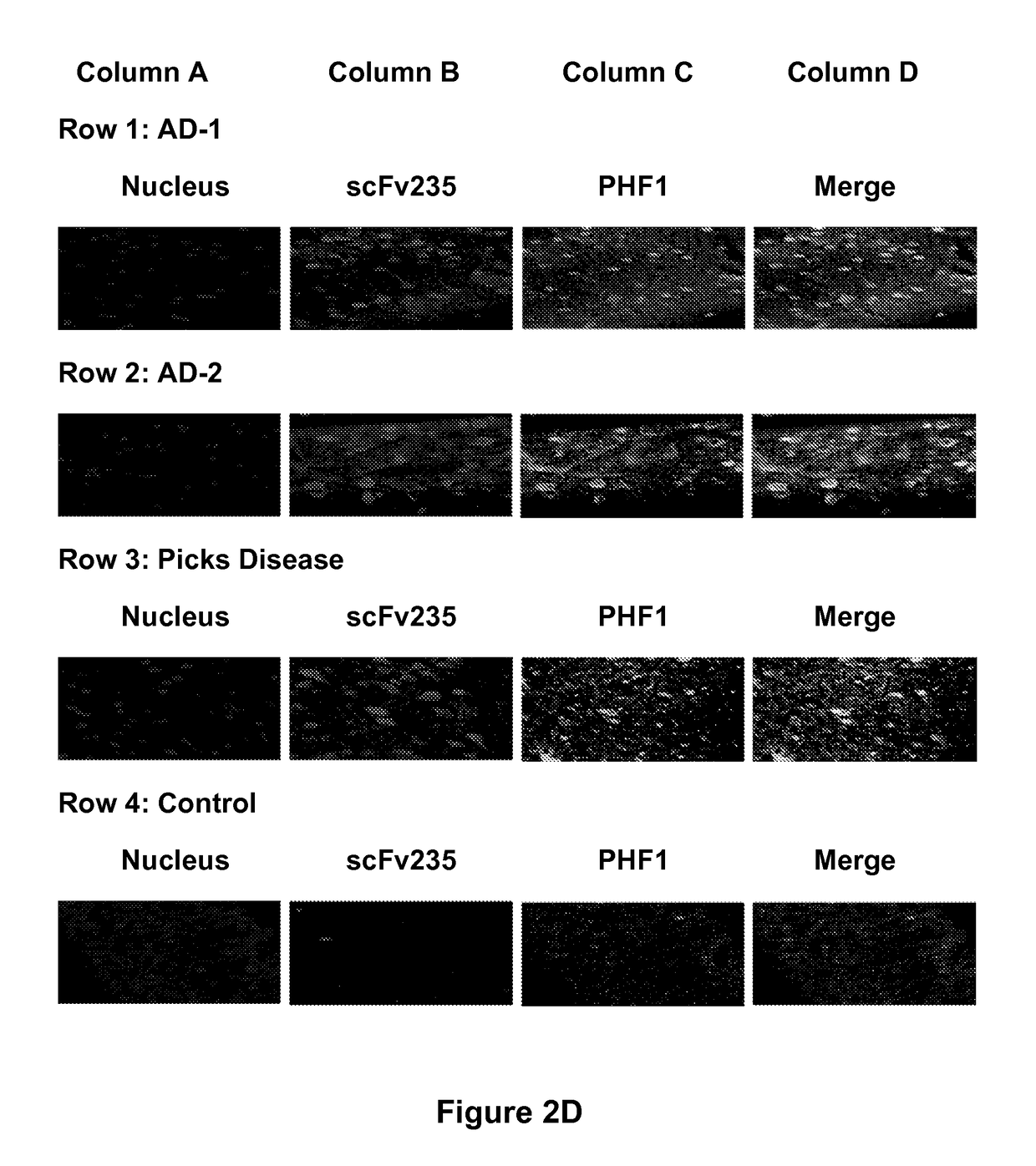 Tau Imaging Ligands and Their Uses in the Diagnosis and Treatment of Tauopathy