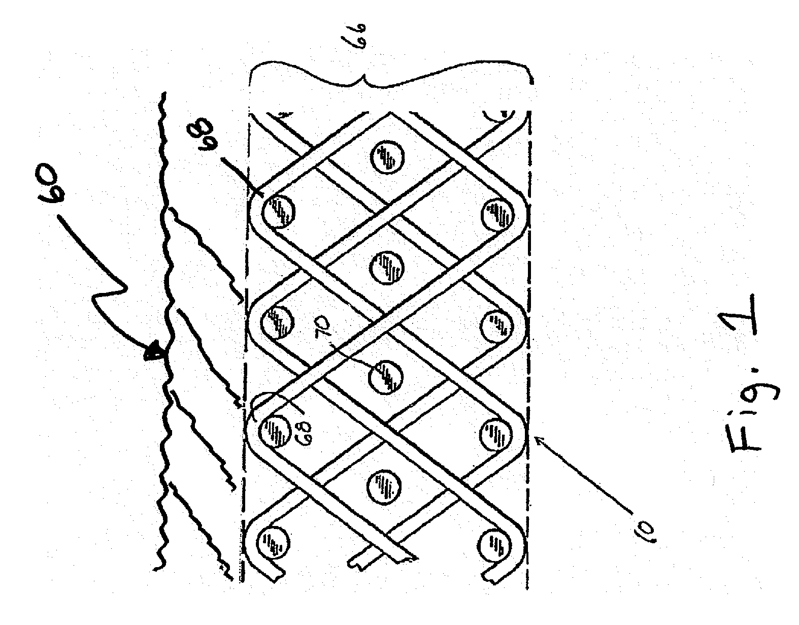 Needled corrugator fabric with pin seam