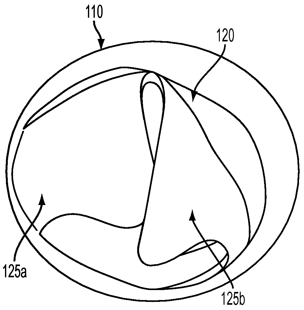 Expandable Implantable Catheter