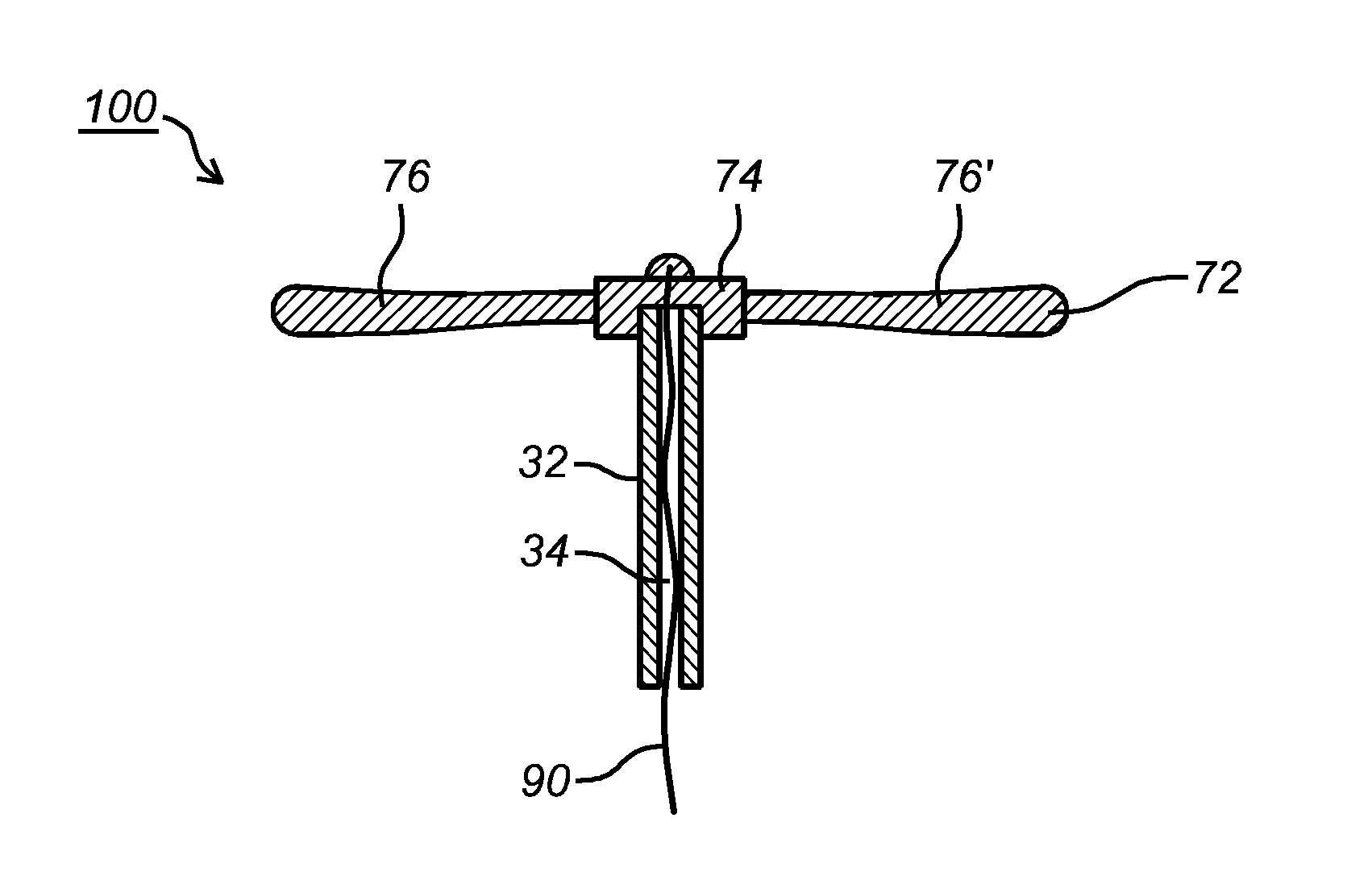 Intrauterine Device