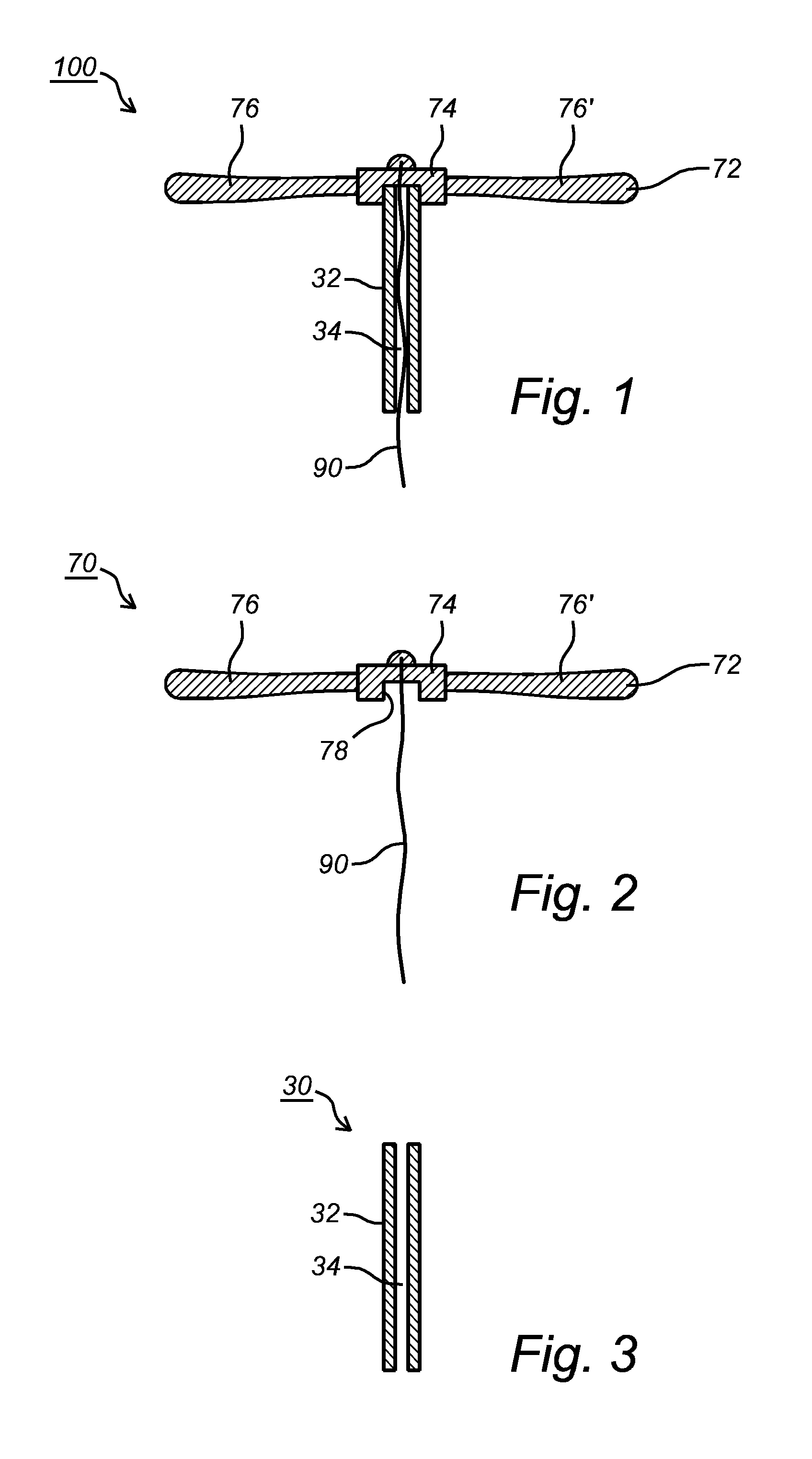 Intrauterine Device