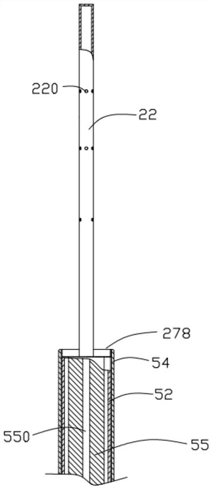 Safety-improved cardiac interatrial septum shunt system