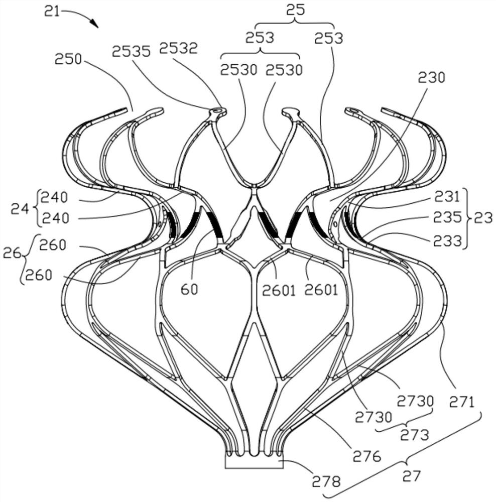 Safety-improved cardiac interatrial septum shunt system