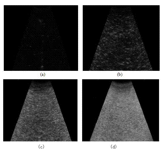 Measurement method for low sand content based on B-type ultrasound imaging technology