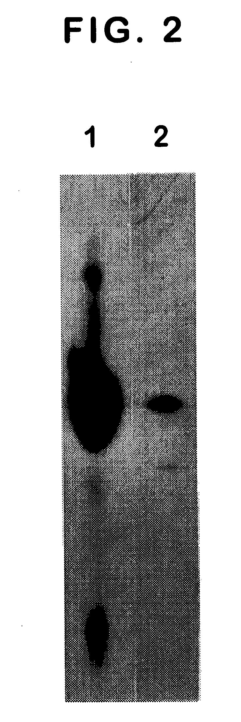 Monoclonal antibody specific for the extracellular domain of prostate specific membrane antigen