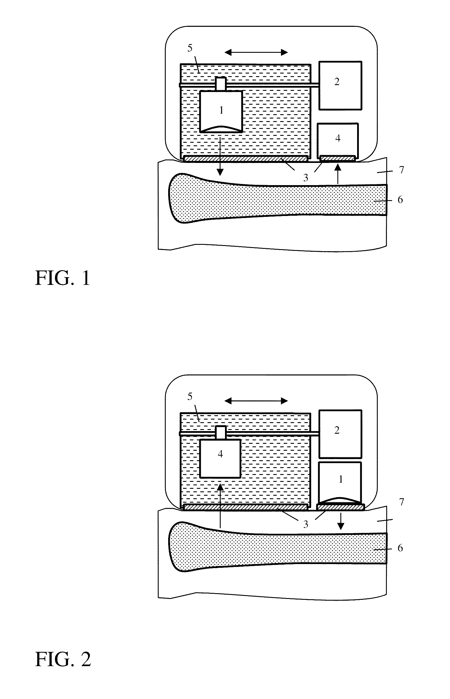 Ultrasonometer for bone assessment in infants