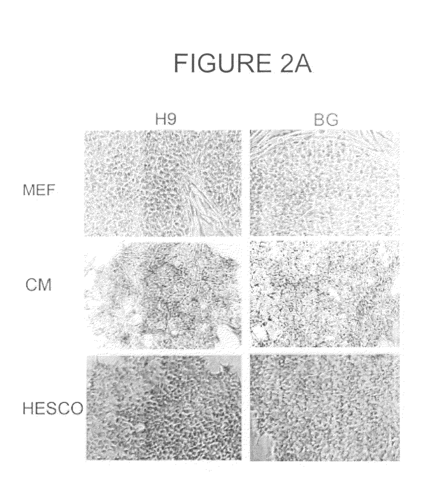 Defined Culture Conditions of Human Embryonic Stem Cells