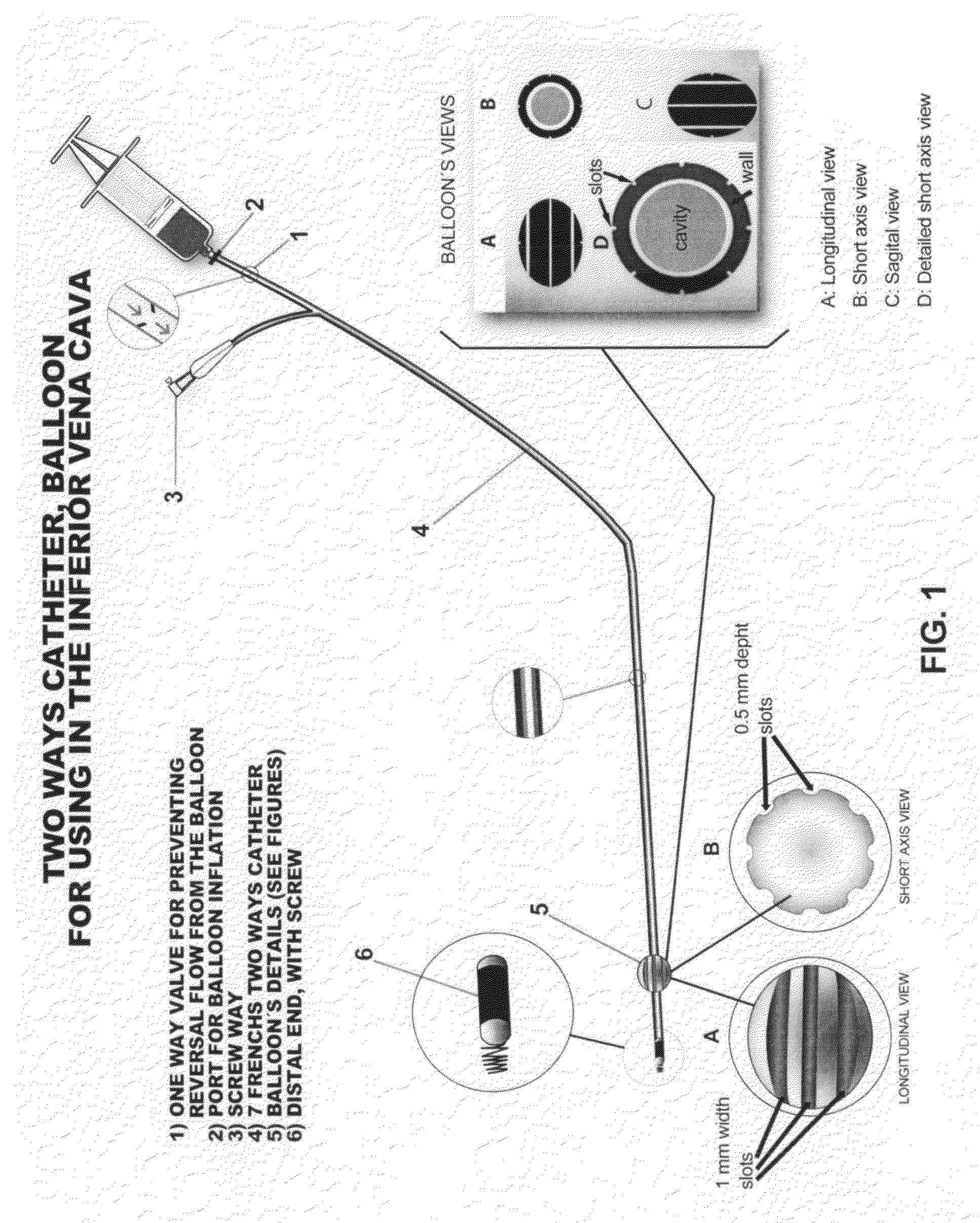 Method and a catheter device for the dynamic regulation of the venous return to the heart for the treatment of patients with heart failure