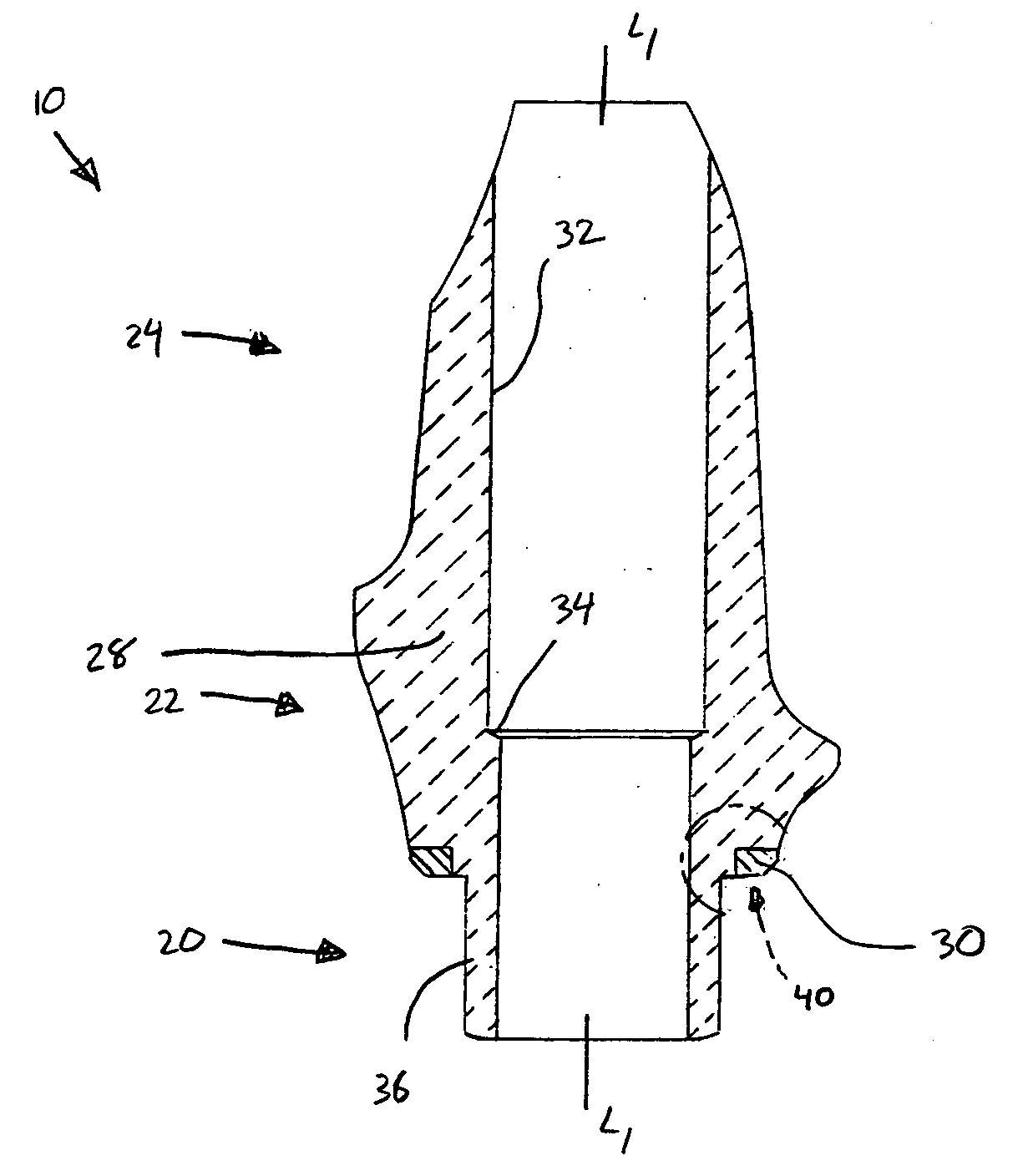 Ceramic/metallic dental abutment