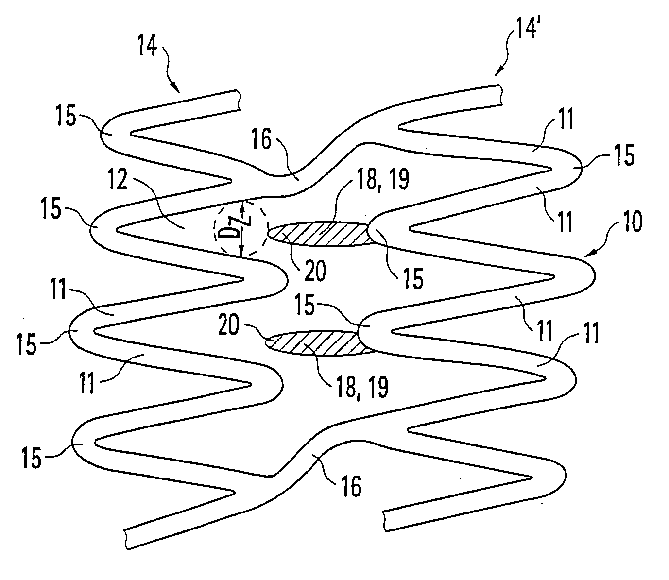 Stent and method for producing a stent