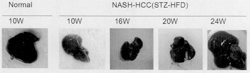 Fatty-liver-related liver cancer model building method based on knockout mice