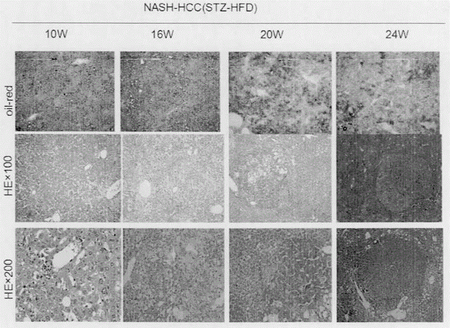 Fatty-liver-related liver cancer model building method based on knockout mice