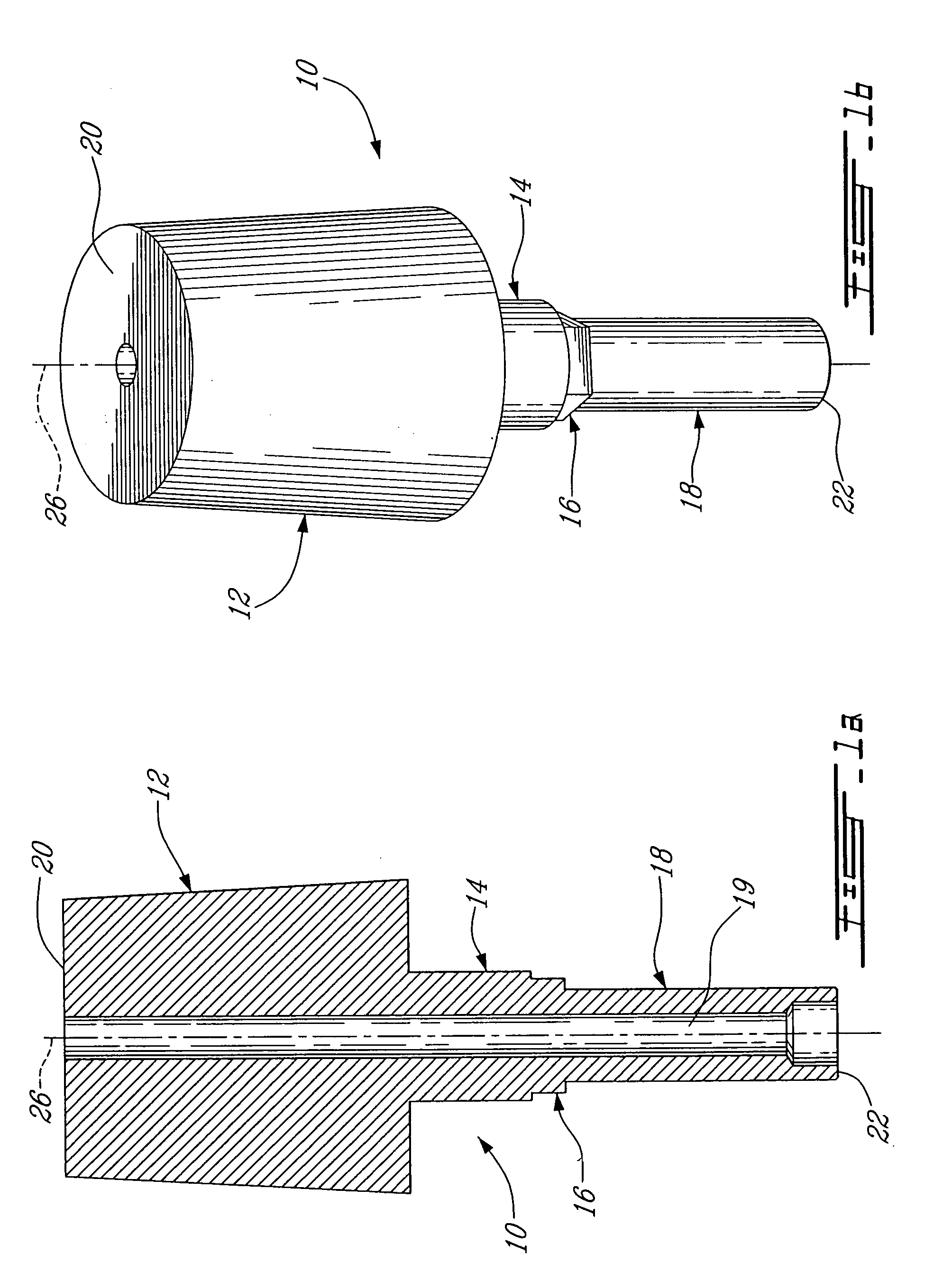 Implant system and method of installation thereof