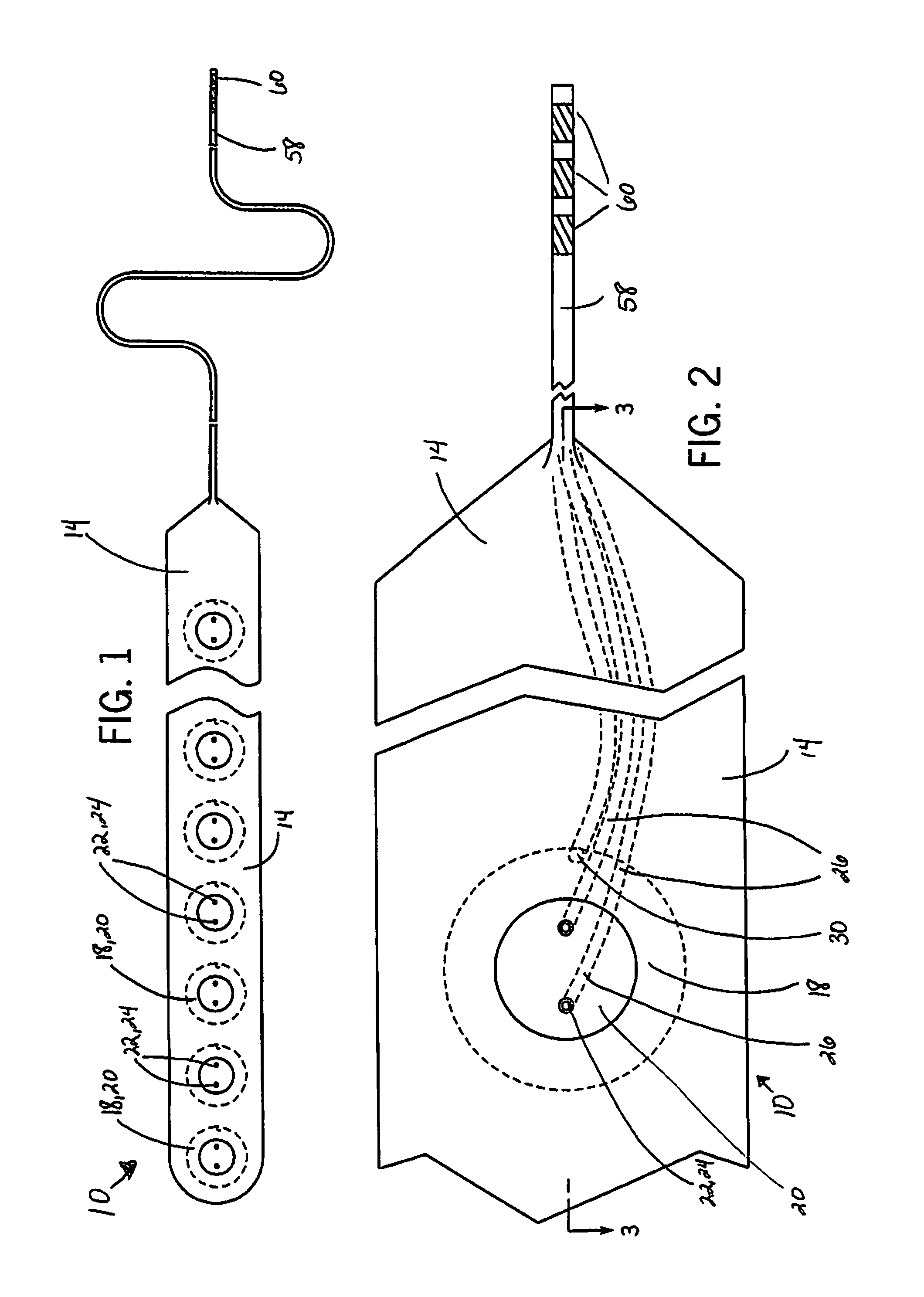 Intracranial sensing & monitoring device with macro and micro electrodes