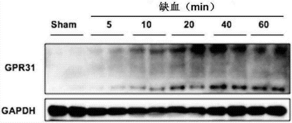 Application of GPR31 inhibitor in pharmacy