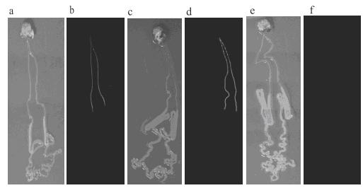 Domestic silkworm cuticle protein BmCP231 promoter as well as recombinant expression vector and application thereof