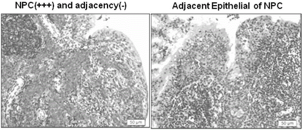 Application of long-chain non-coding RNA (ribonucleic acid) gene LOC553103