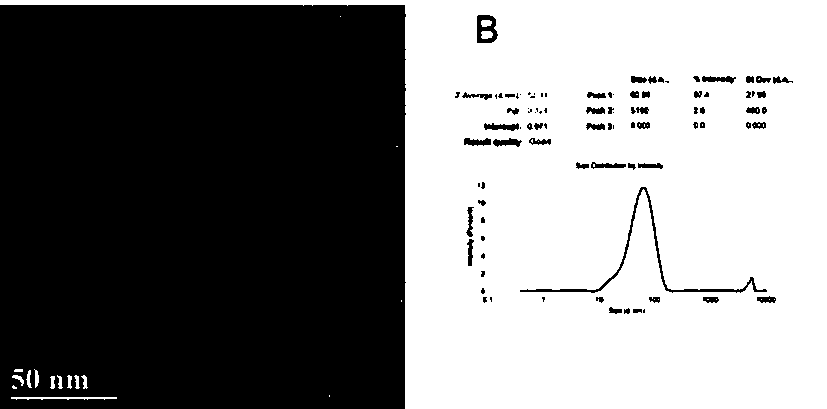 Ocular surface drip anti-angiogenesis eye-drops preparation and preparation method thereof