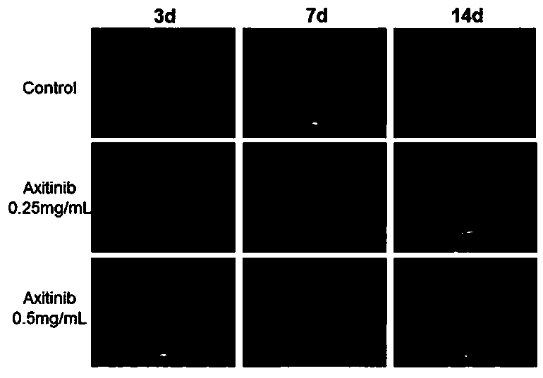 Ocular surface drip anti-angiogenesis eye-drops preparation and preparation method thereof