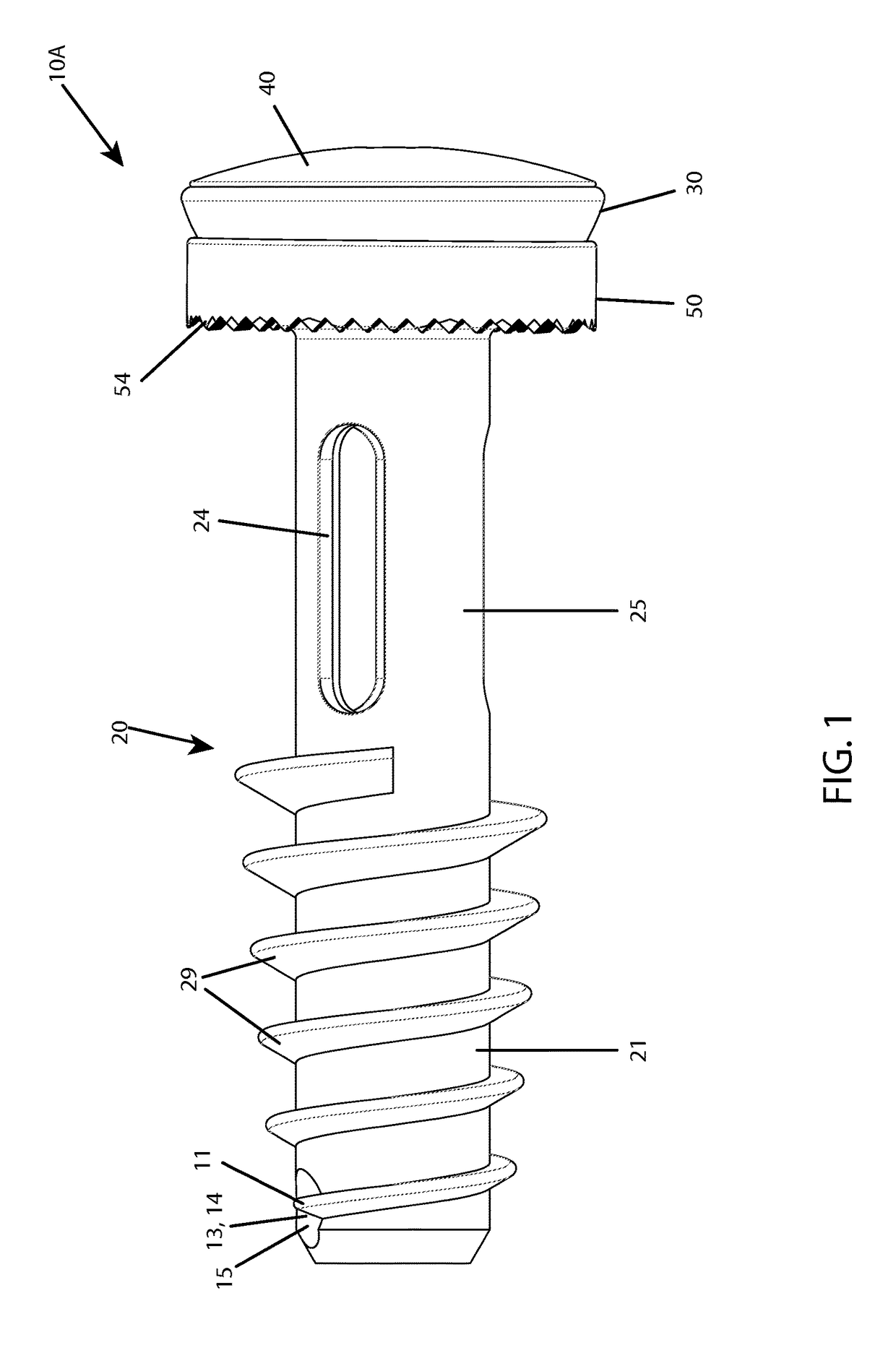 Sacroiliac screw