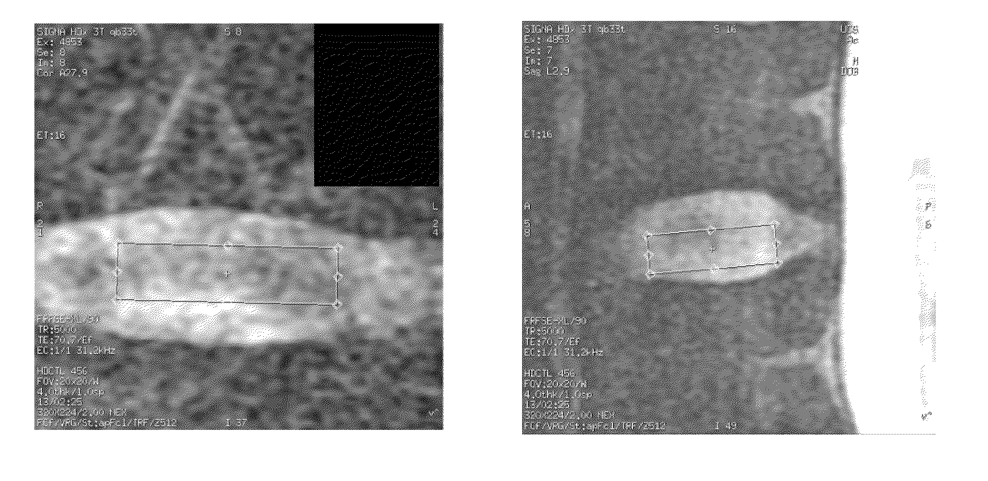 MR spectroscopy system and method for diagnosing painful and non-painful  intervertebral discs