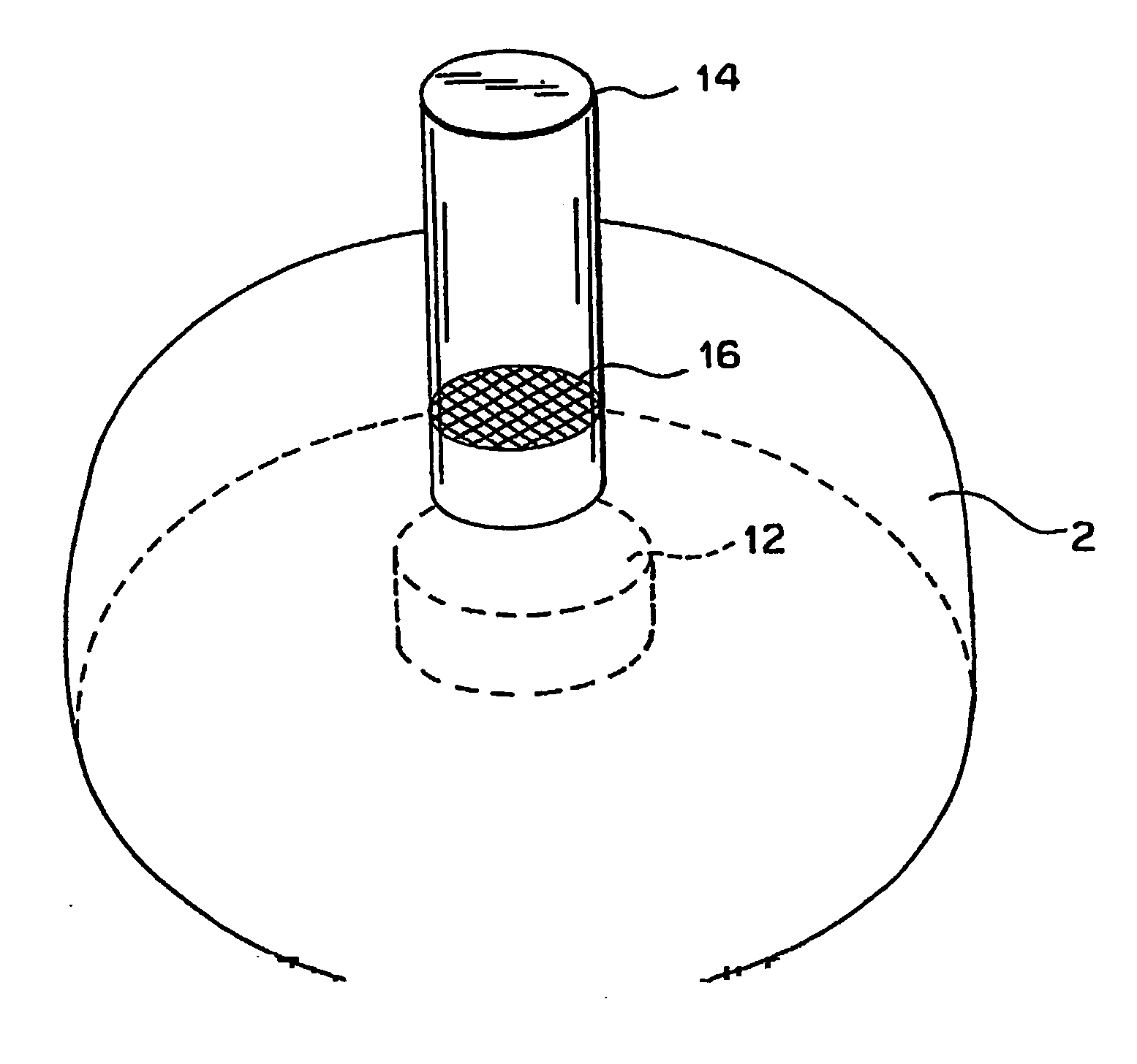 Hearing aid that facilitates removal of earwax and trapping of moisture