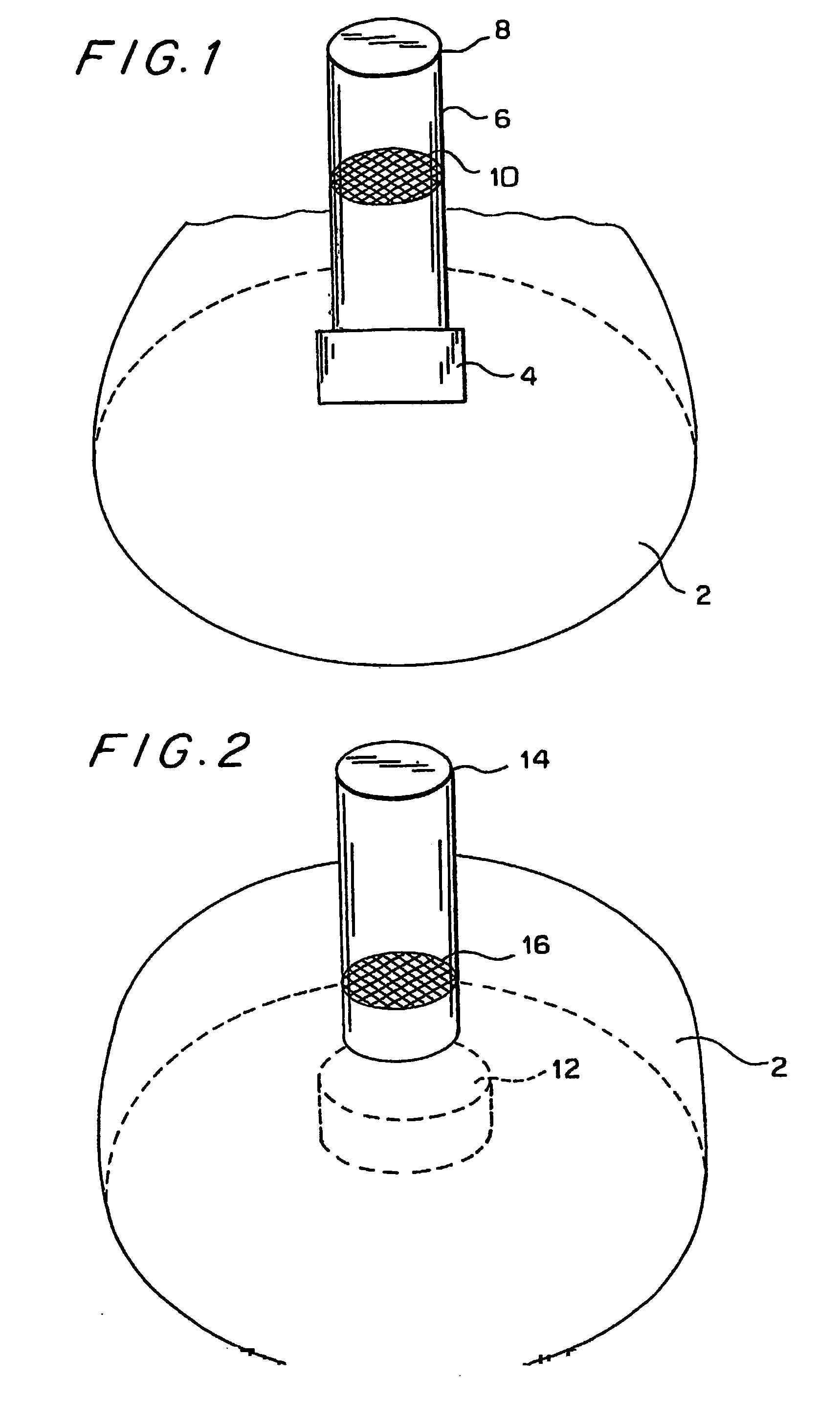 Hearing aid that facilitates removal of earwax and trapping of moisture