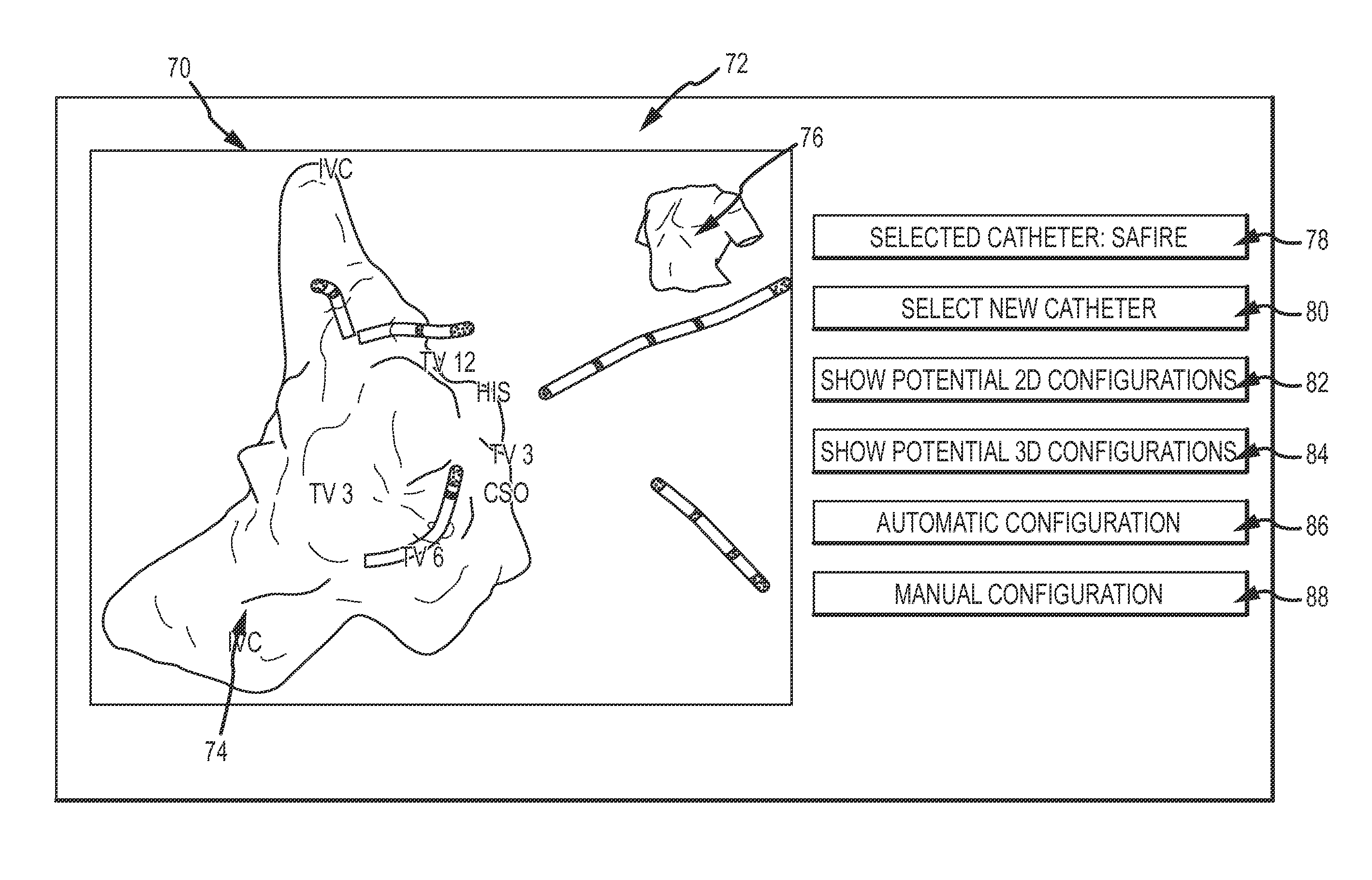 Catheter configuration interface and related system