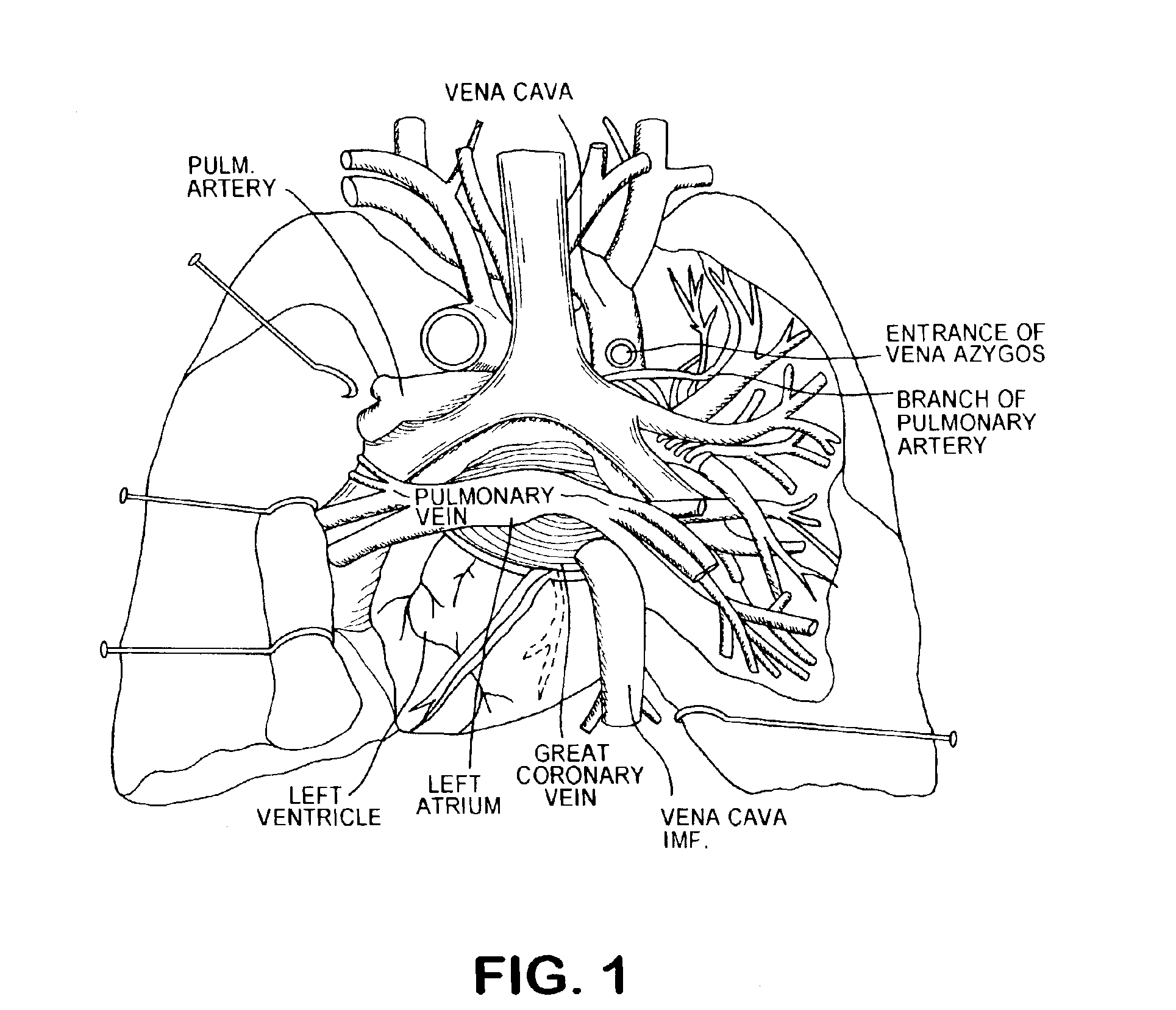 Transbronchial reflectance oximetric measurement of mixed venous oxygen saturation, and device therefor