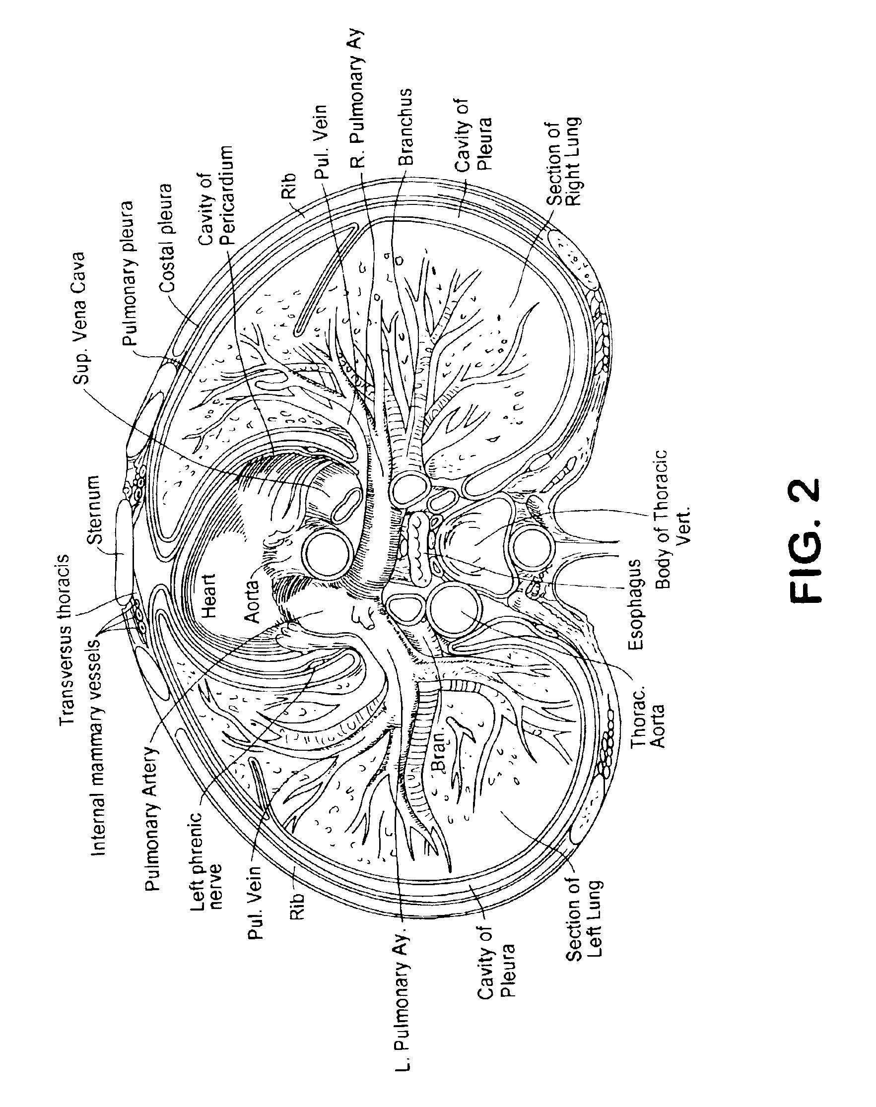 Transbronchial reflectance oximetric measurement of mixed venous oxygen saturation, and device therefor