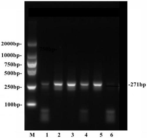 LncRNA marker and application of LncRNA marker to diabetes