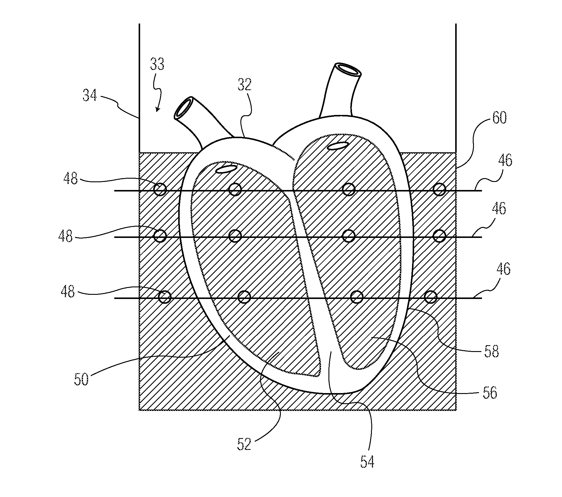 Anatomically and functionally accurate soft tissue phantoms and method for generating same