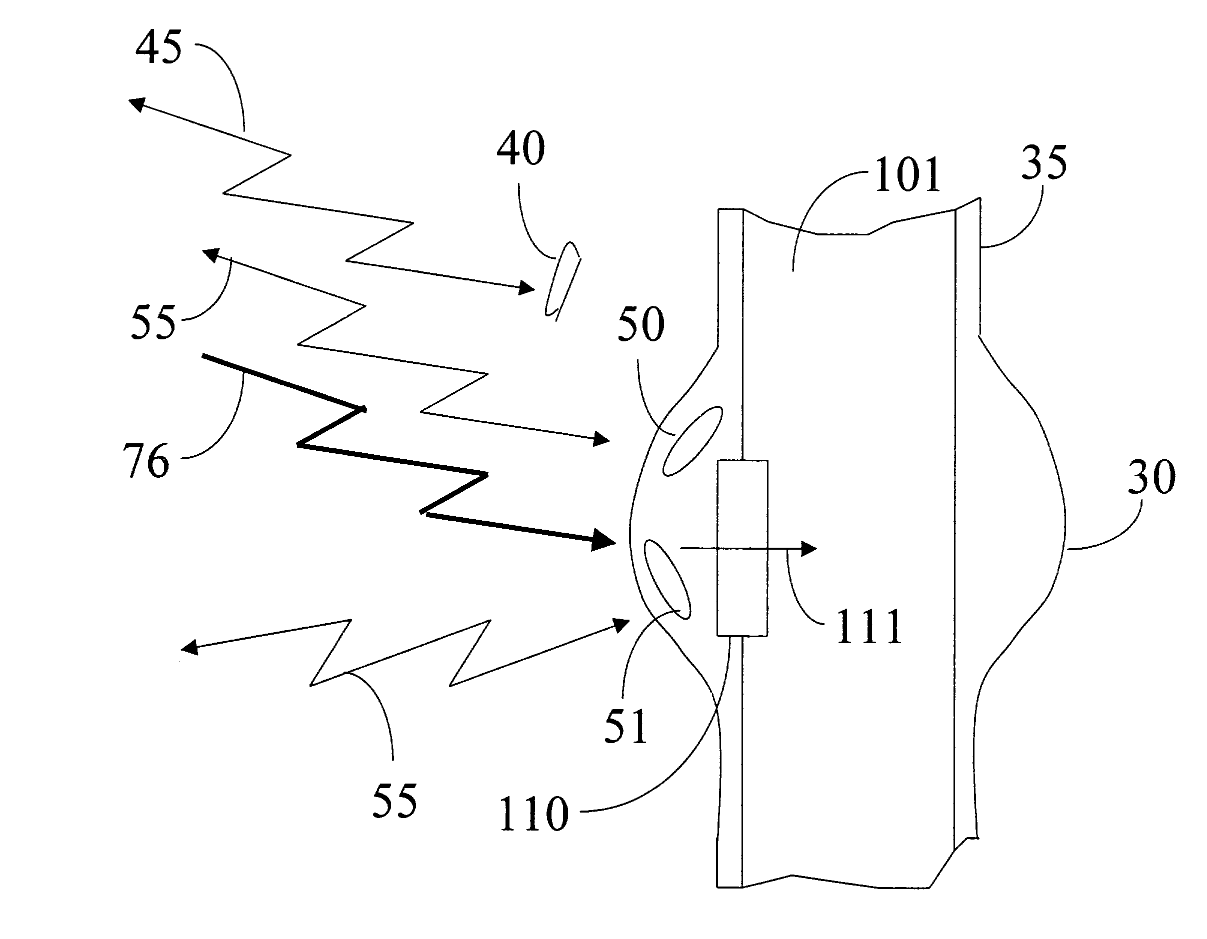 Pressure monitoring system to prevent aneurismal sac rupture