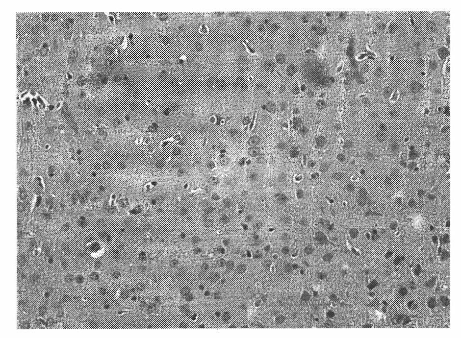 Preparation method of composite animal model with Alzheimer disease