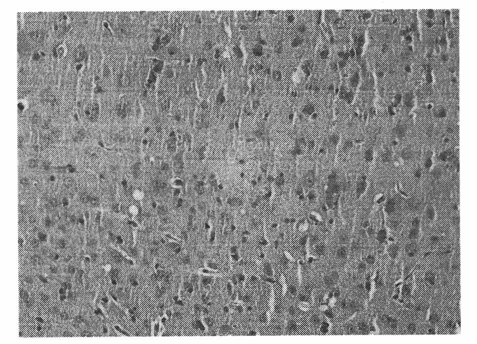 Preparation method of composite animal model with Alzheimer disease