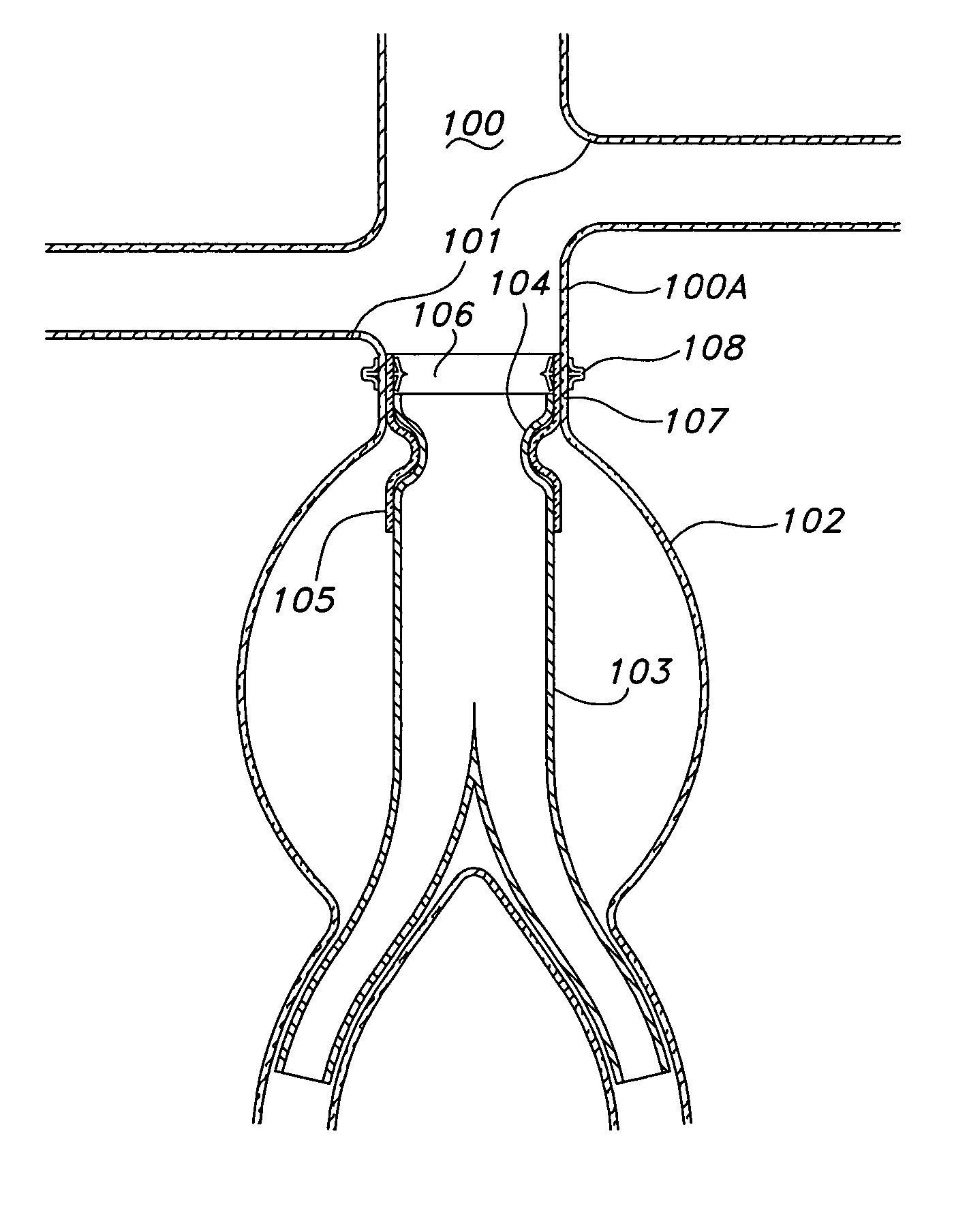 Prosthesis fixation device and method