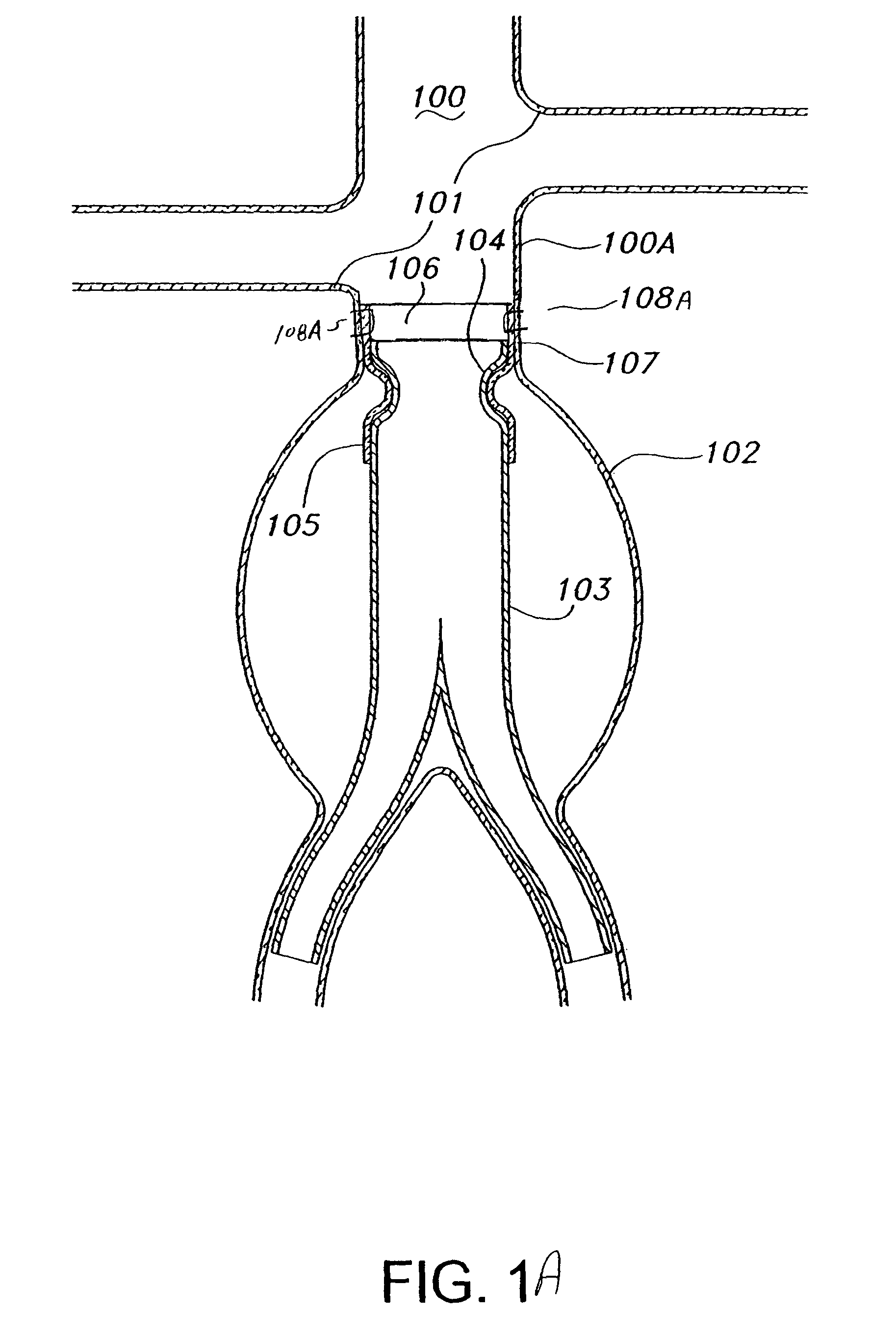 Prosthesis fixation device and method