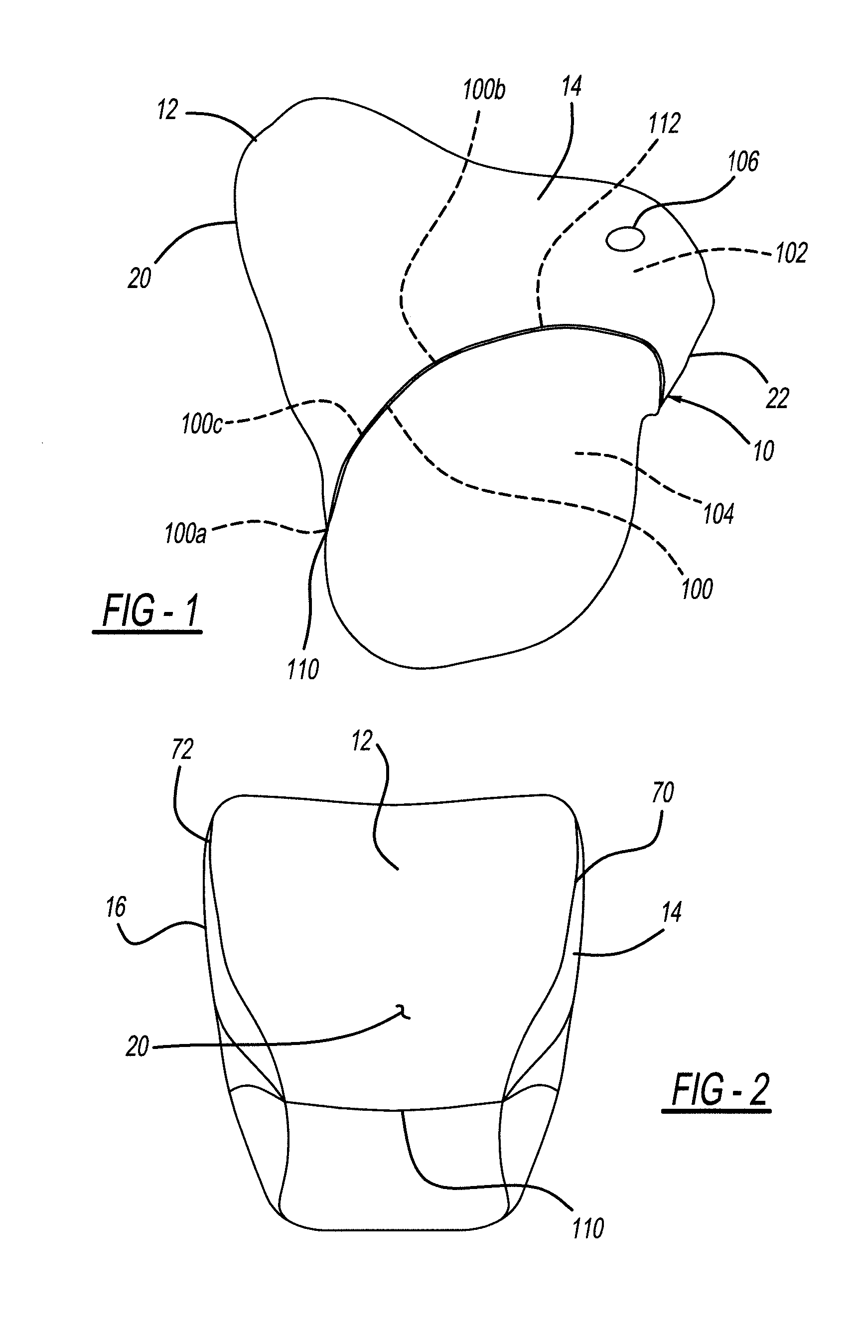 Dual Chambered Passenger Airbag