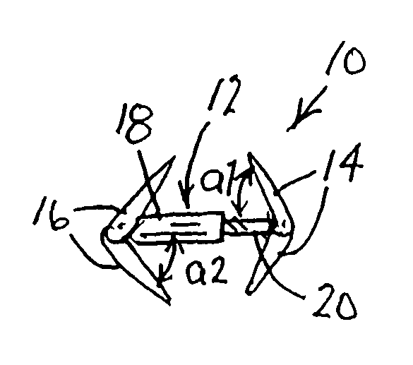 Method and device for improving cardiac function