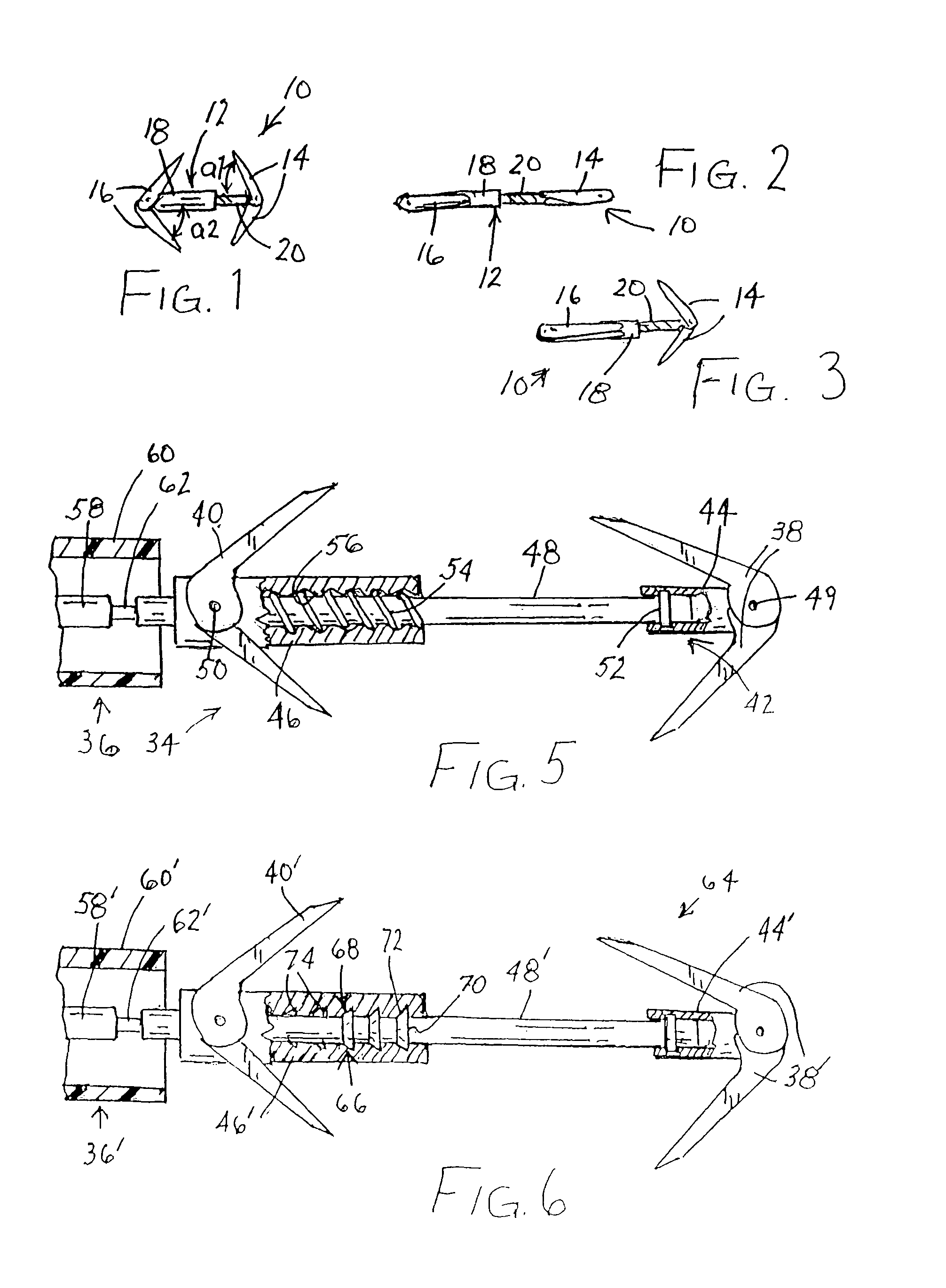 Method and device for improving cardiac function