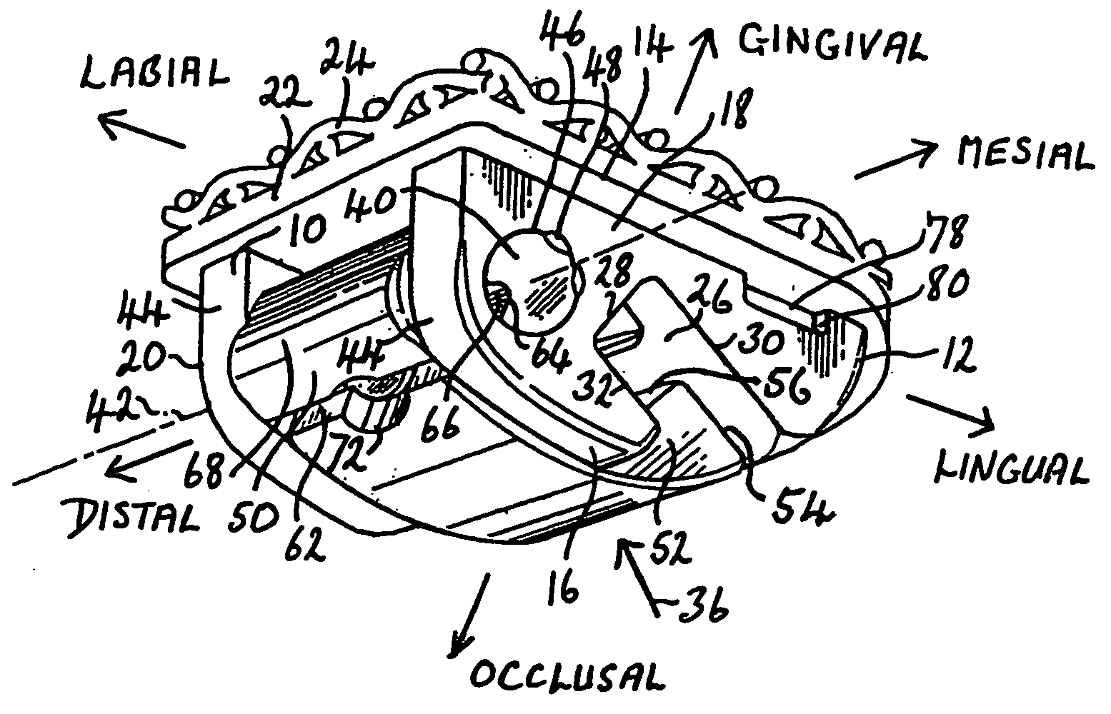 Orthodontic devices for use with arch wires