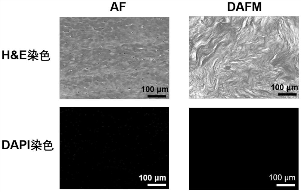 Injectable photo-crosslinking acellular matrix composite hydrogel as well as preparation method and application thereof