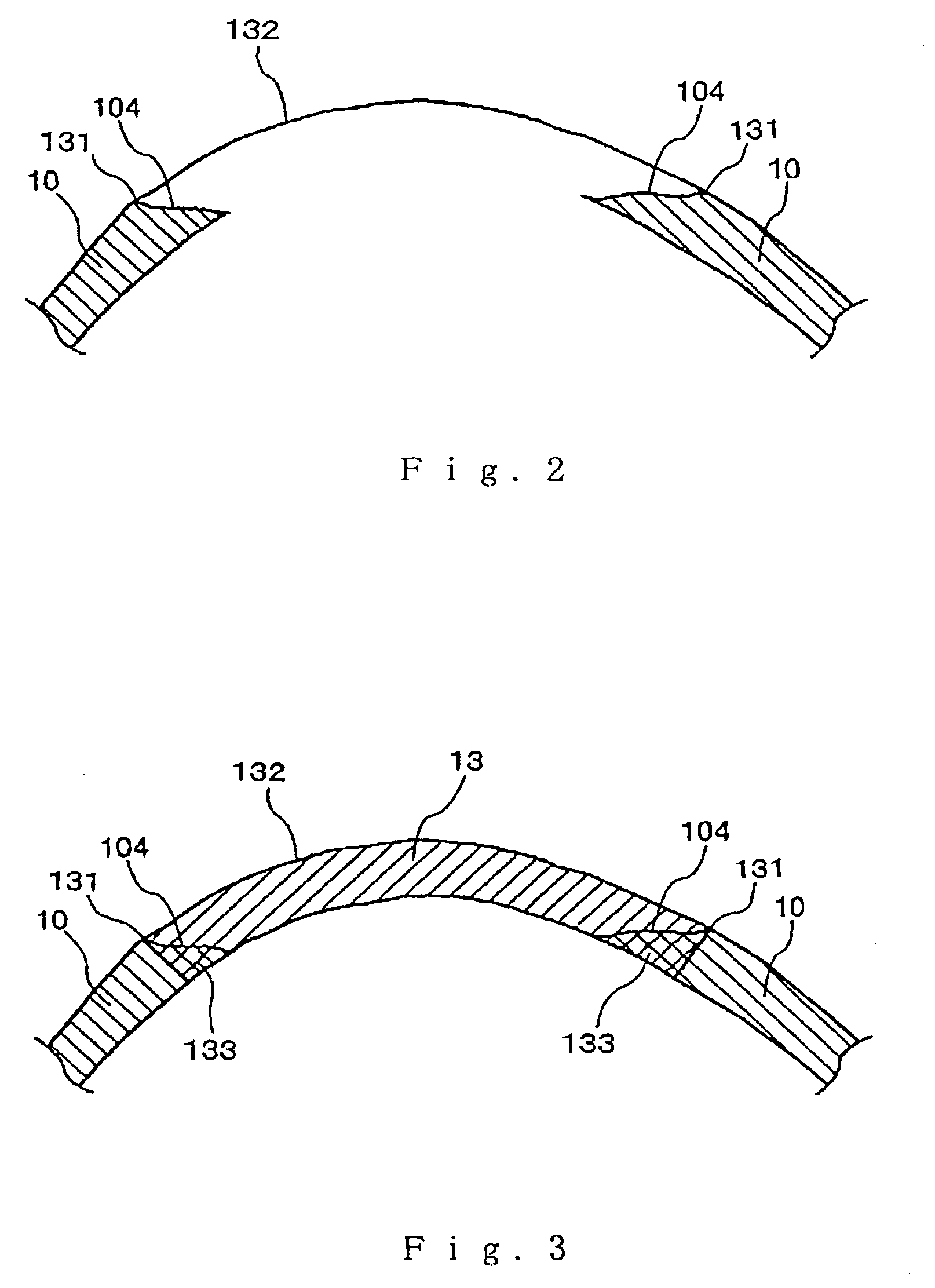 Method for modeling an implant and an implant manufactured by the method